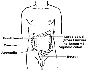 A diagram showing the different parts of the large bowel.